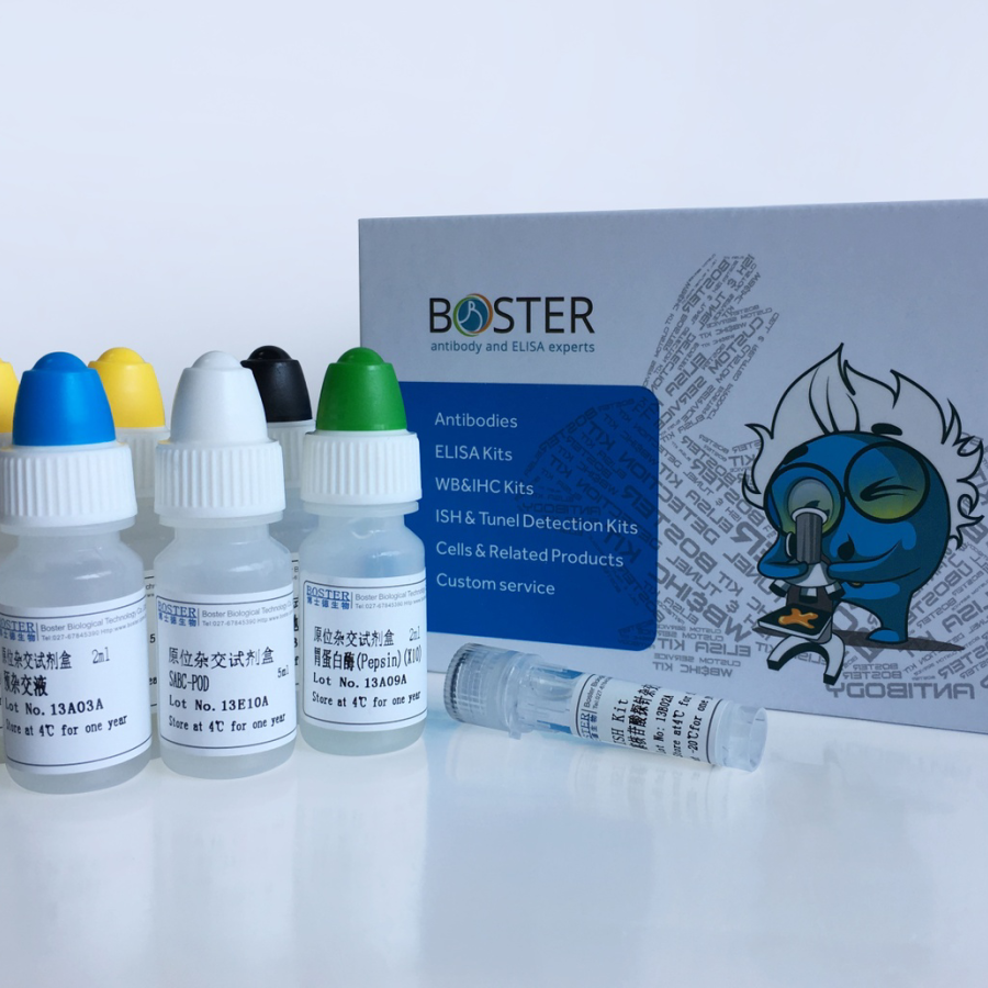 S-100A7 mRNA原位杂交试剂盒