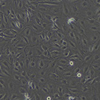 人肝胆管癌细胞；RBE